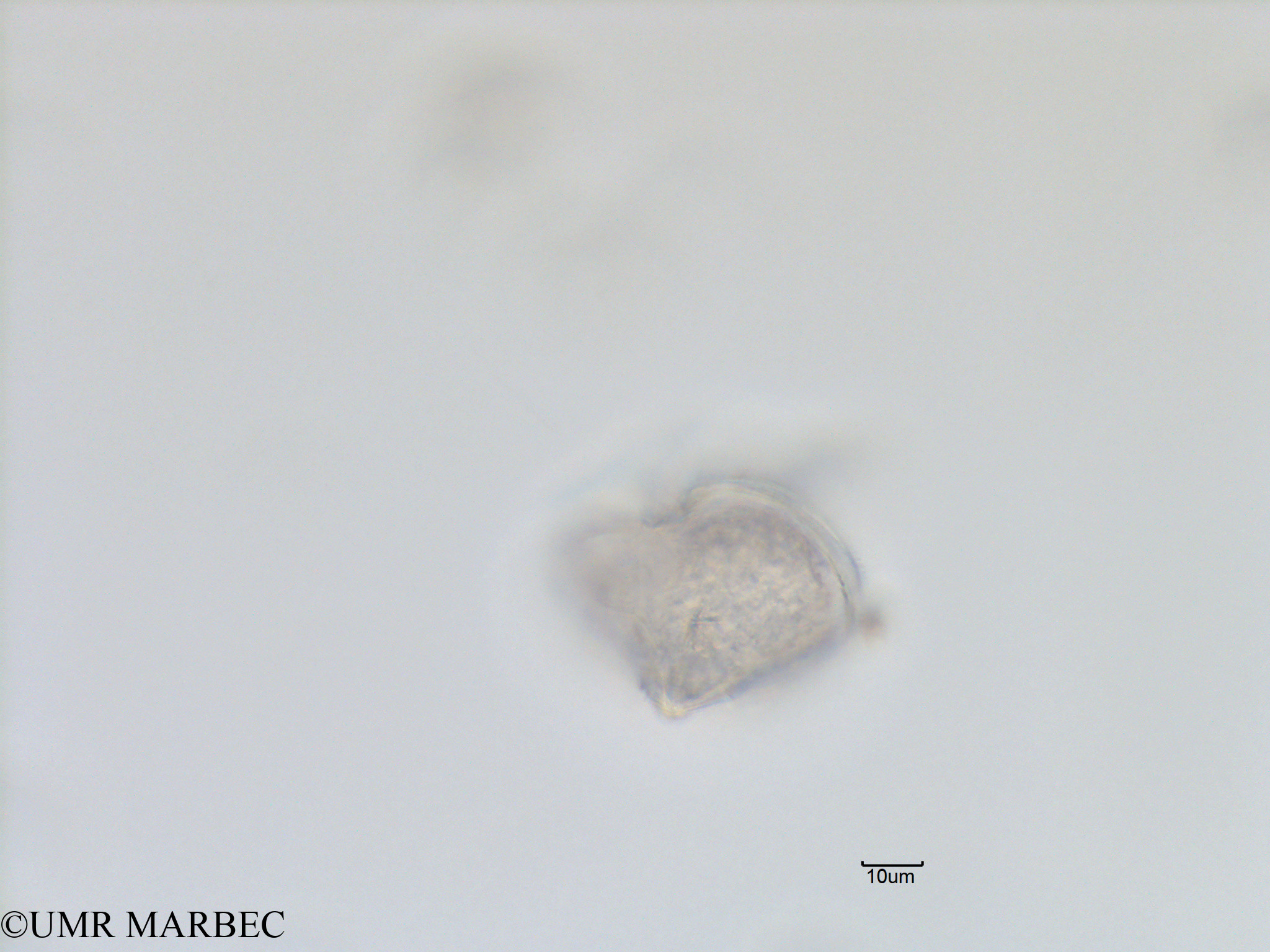 phyto/Bizerte/bizerte_lagoon/RISCO November 2015/Protoperidinium sp48 (Lagune_T1_B_Proto lequel-9).tif(copy).jpg